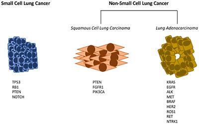 Targeting the Complement Pathway as a Therapeutic Strategy in Lung Cancer